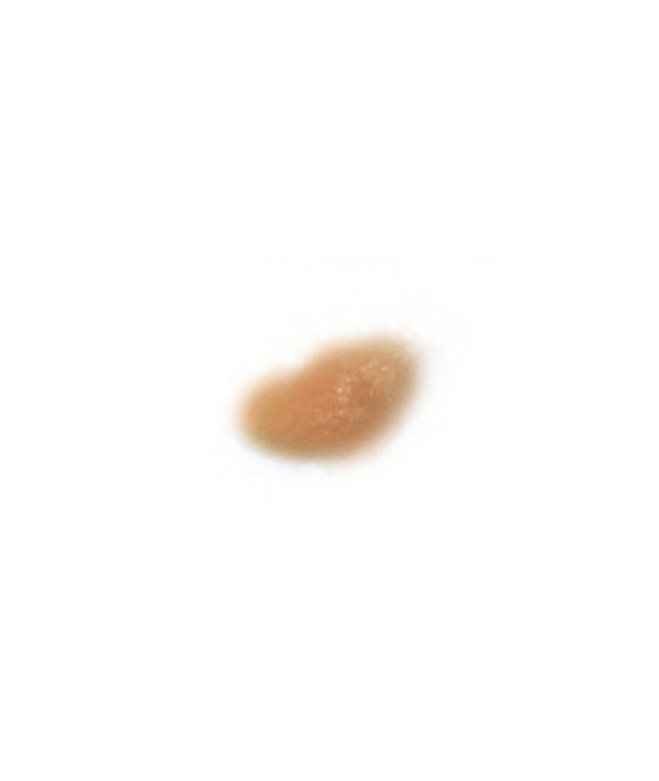 Cold Sore 1