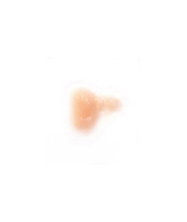 Cold Sore 4