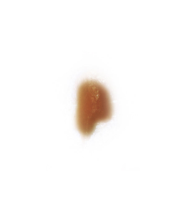 Cold Sore 5