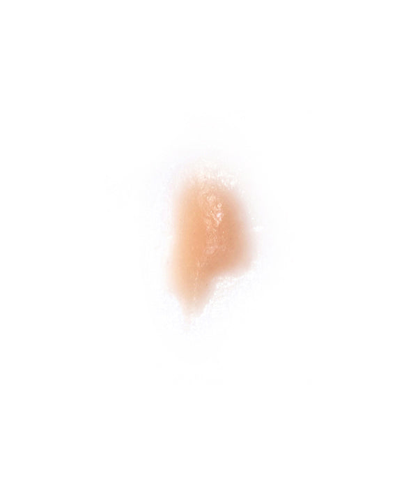 Cold Sore 5