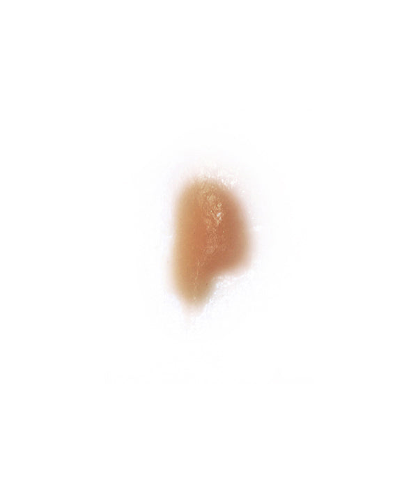 Cold Sore 5