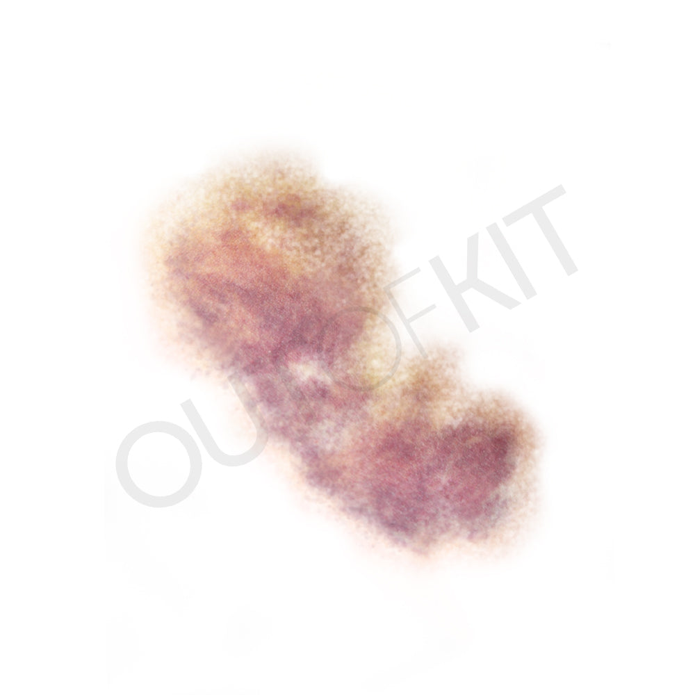 Bruise 5