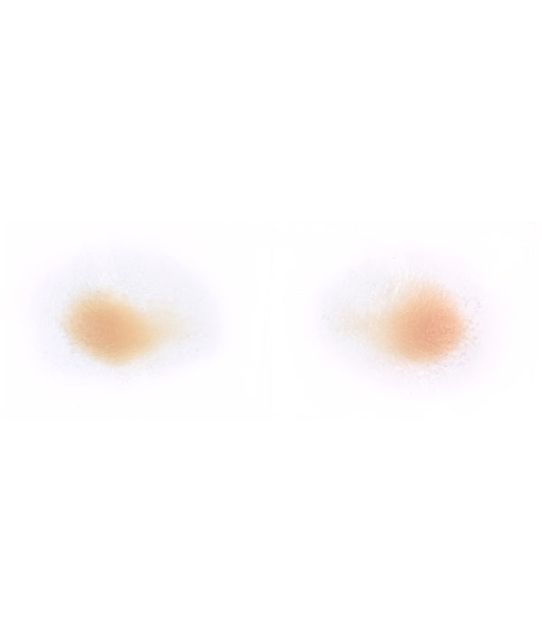 Male Jowls 1