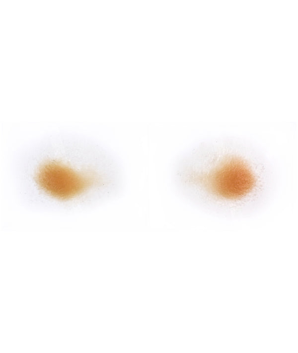 Male Jowls 1