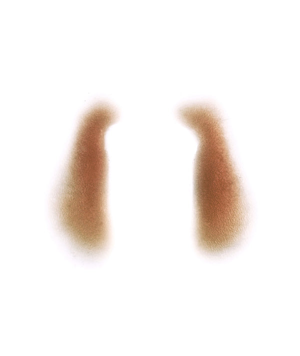 Female Nasolabial Folds 2