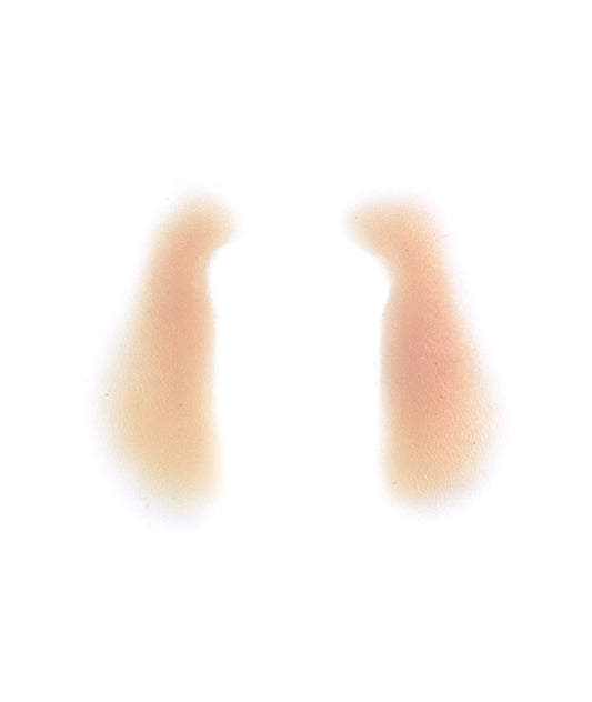 Female Nasolabial Folds 2