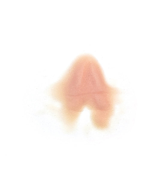 Male Neck Waddle 1