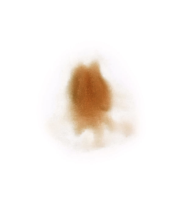 Female Neck Waddle 2