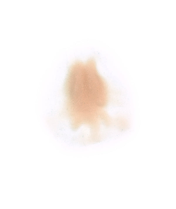 Female Neck Waddle 2