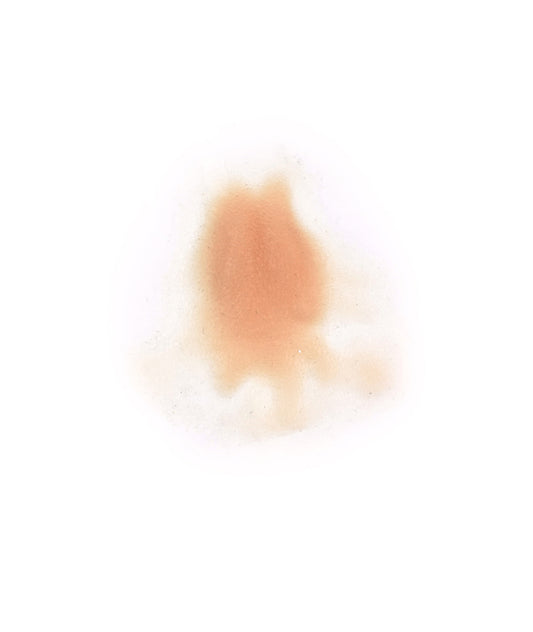 Female Neck Waddle 2