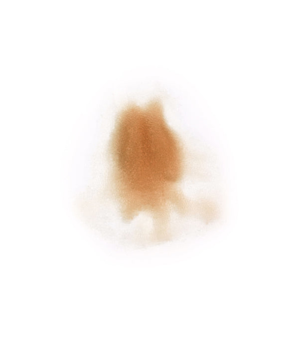 Female Neck Waddle 2