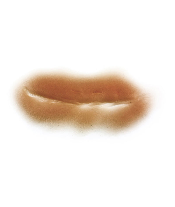 Large stomach scar