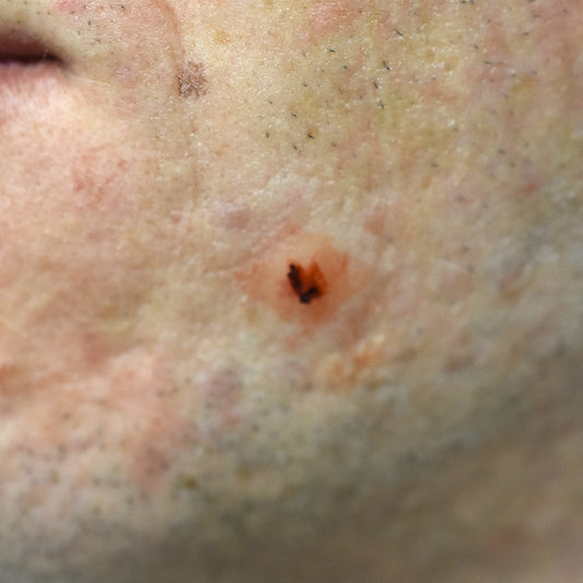 Track mark