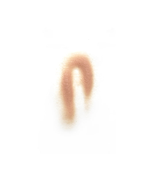 Female Neck Waddle 3