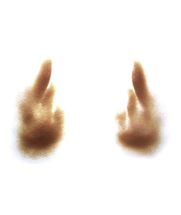 Female Nasolabial Folds with Jowls 3