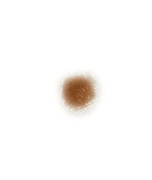 Small boil