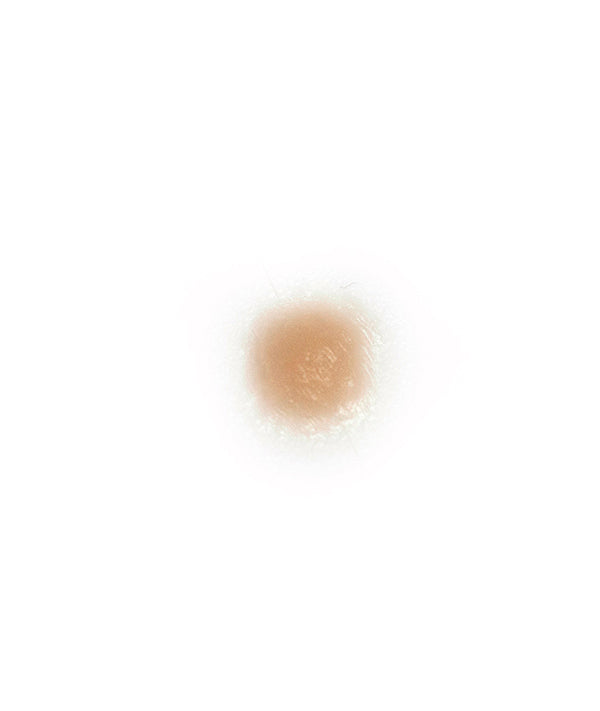 Small boil