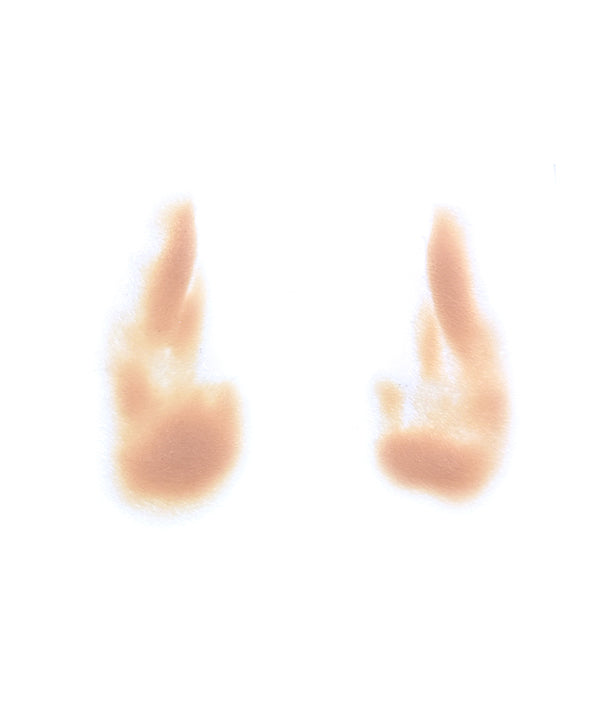 Female Nasolabial Folds with Jowls 1