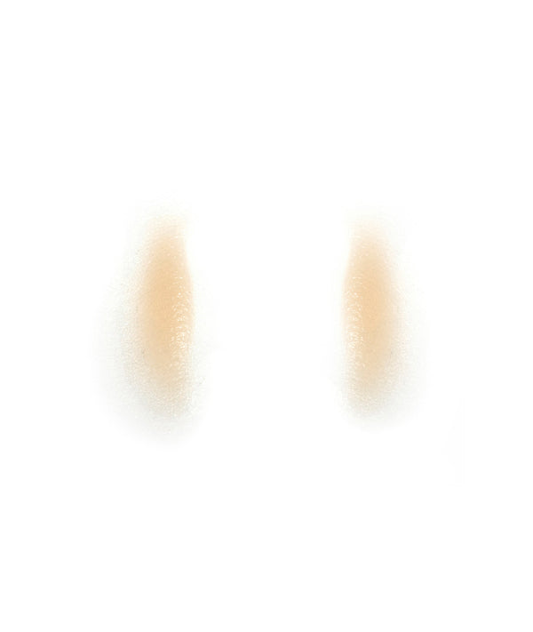 Male Nasolabial Folds 3