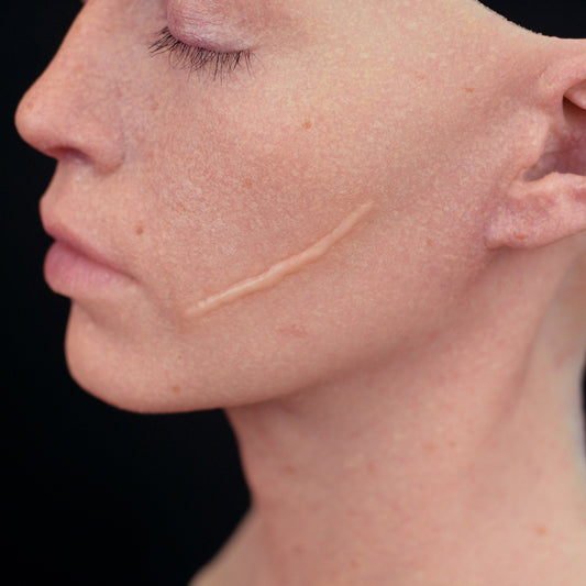 Single Scar (Medium)