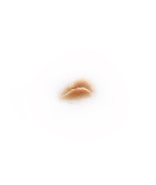 Curved Depressed Scar