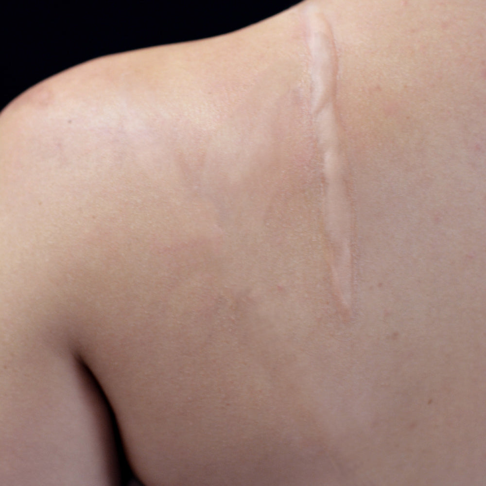 Whip Scar (Large)