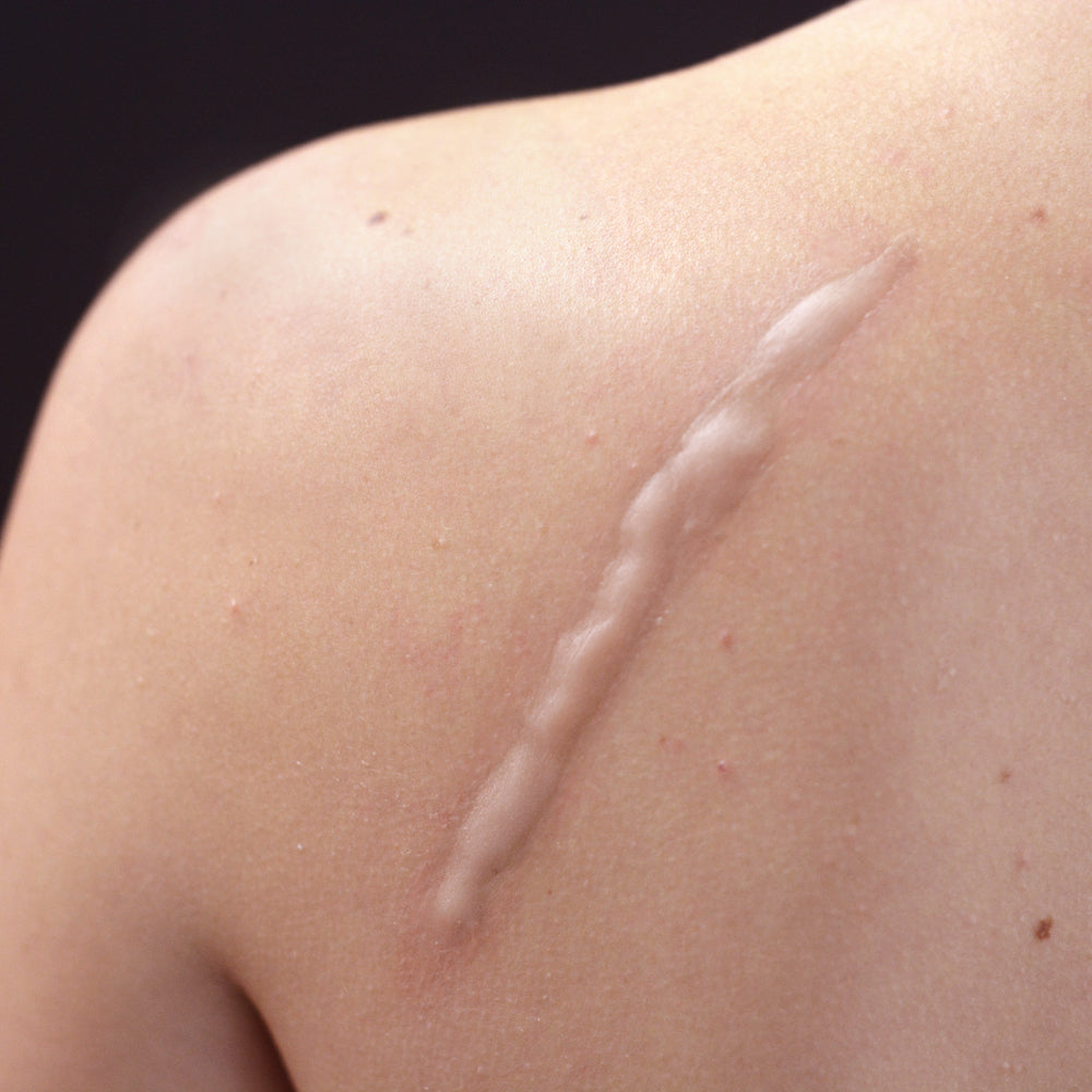 Whip Scar (Medium)