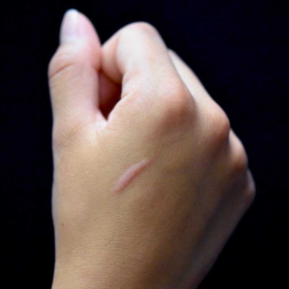 3/4 inch Scar