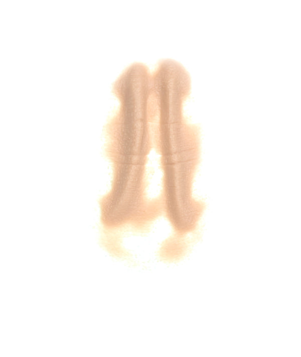 Male Neck Waddle 9