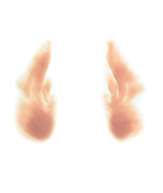 Female Nasolabial Folds with Jowls 2