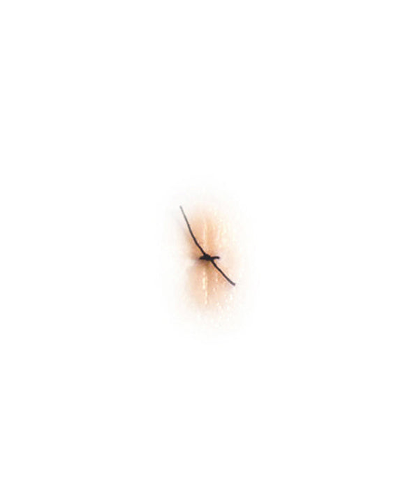 Sutured Wound (Small)