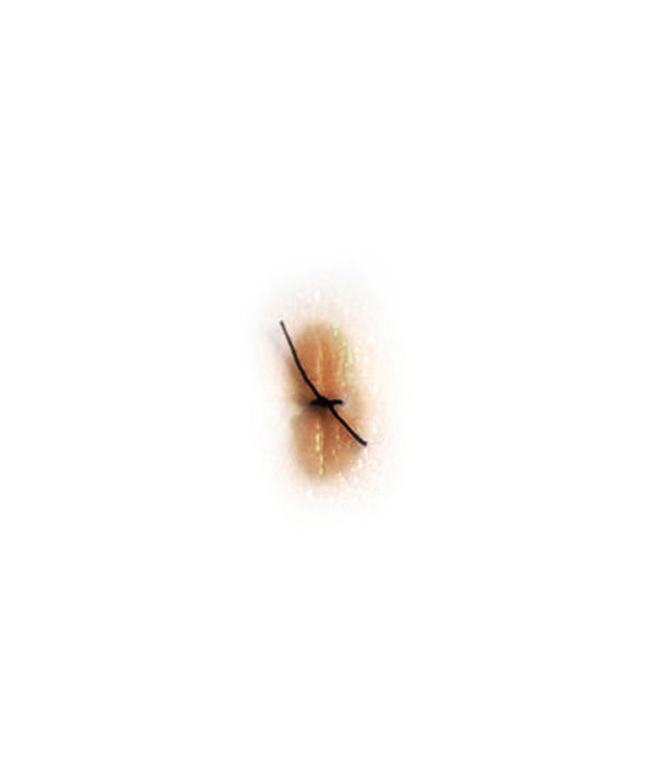 Sutured Wound (Small)
