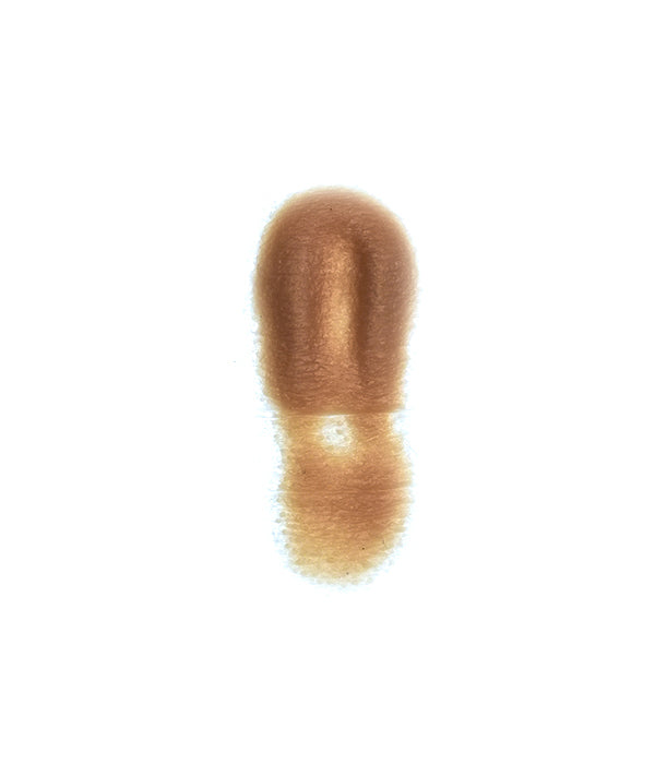 Female Neck Waddle 4