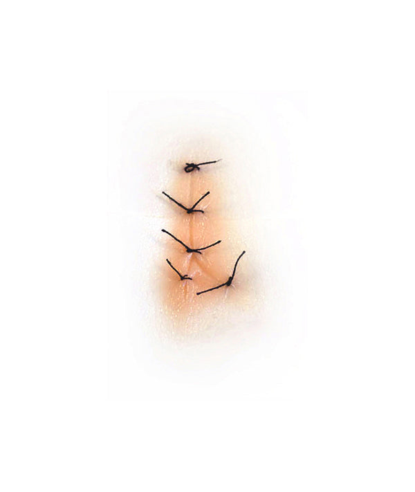 Y Shaped Sutured Wound (Medium)