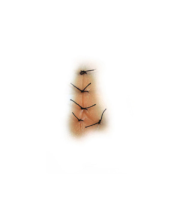 Y Shaped Sutured Wound (Medium)