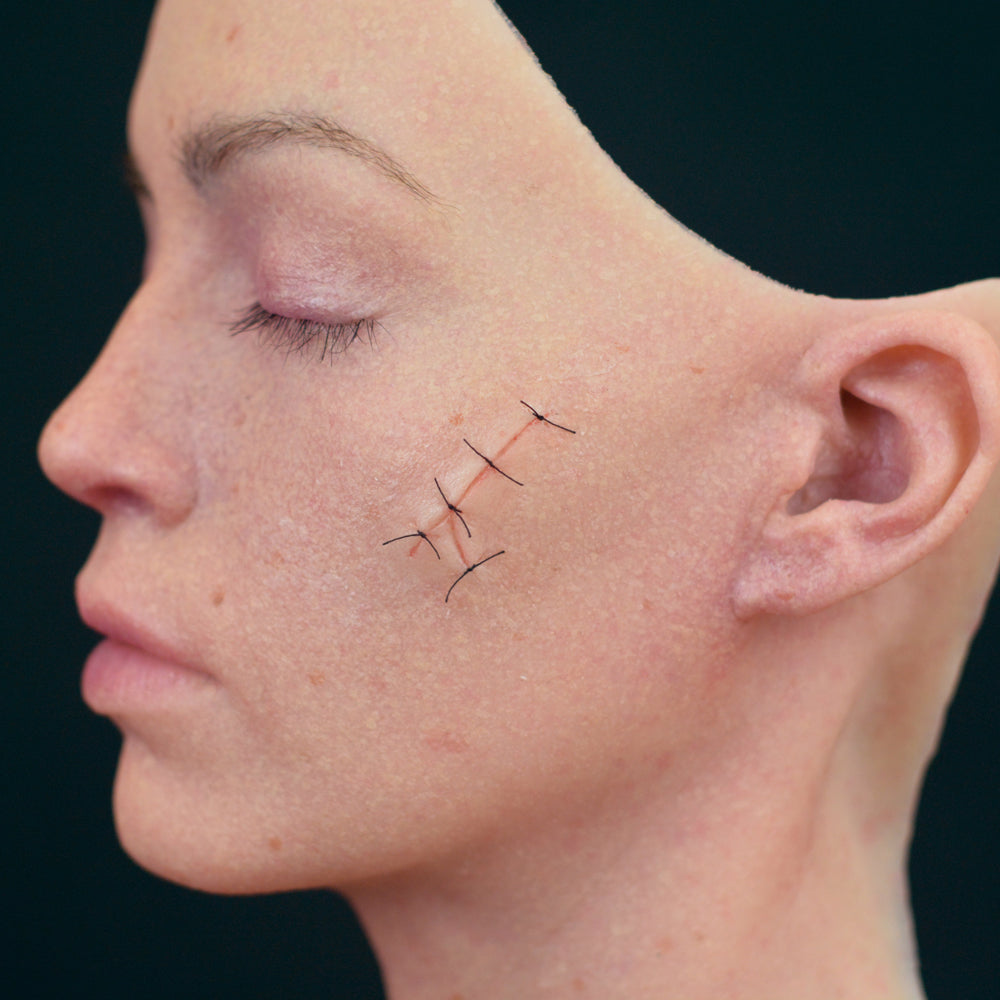 Y Shaped Sutured Wound (Medium)
