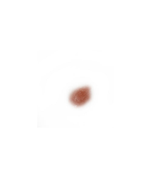 Skin Sarcoma Extra Small