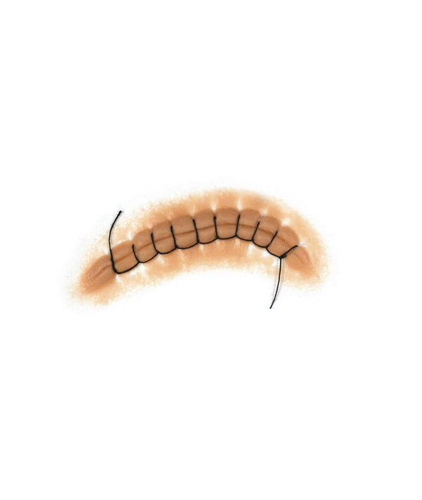 Locking Stitch Suture 1