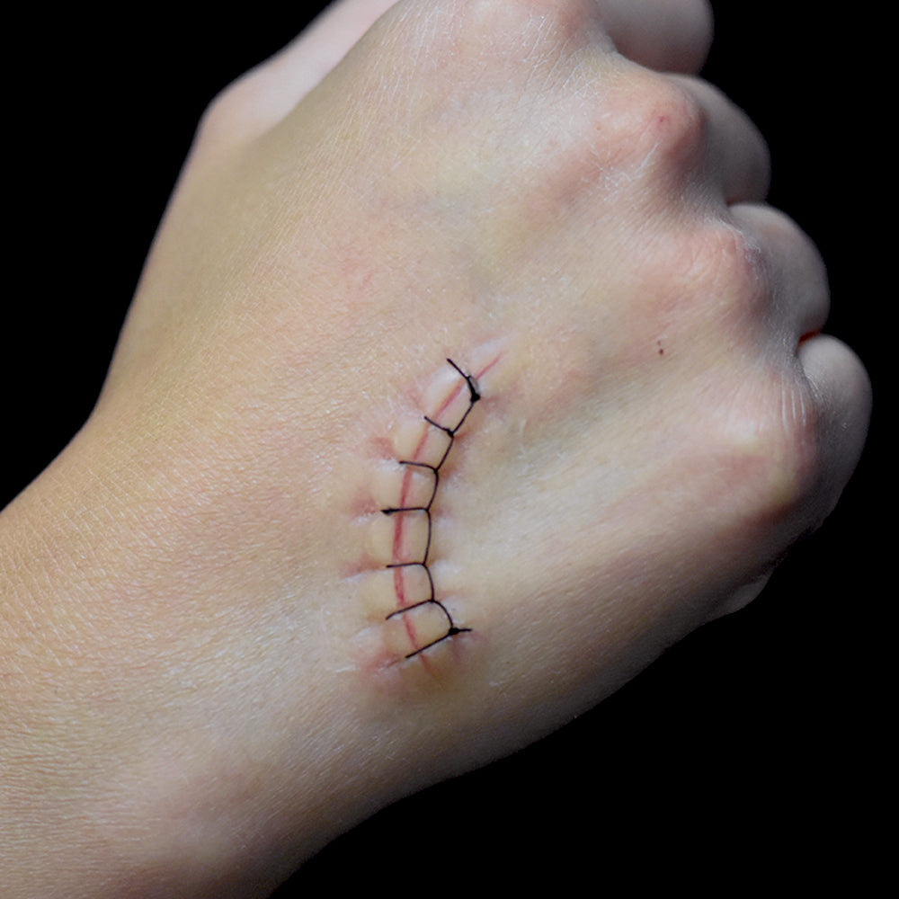Locking Stitch Suture 2