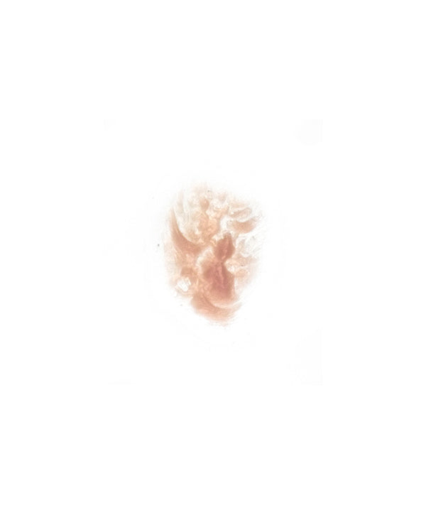 Burn 7