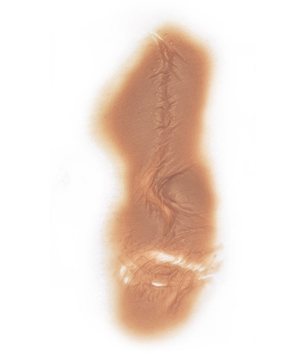 Large Body Scar