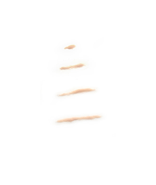 Forearm Scar
