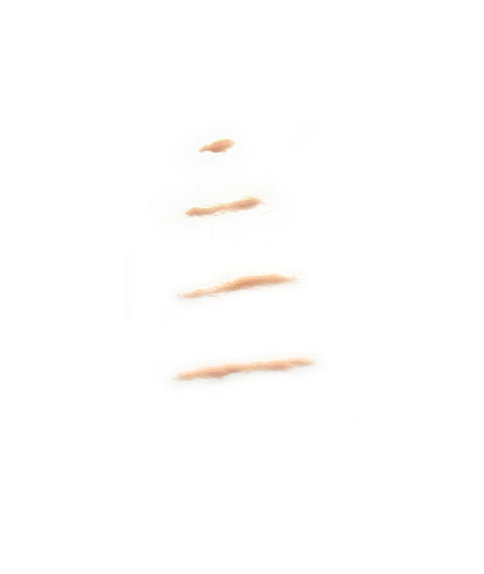 Forearm Scar