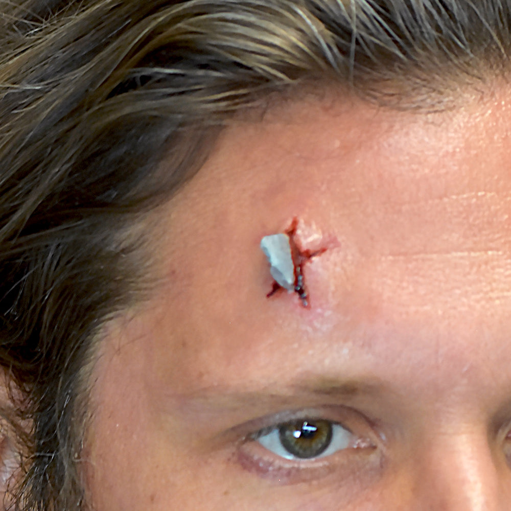 Shrapnel Wound XS