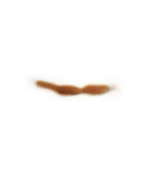 Curved Keloid Scar 6