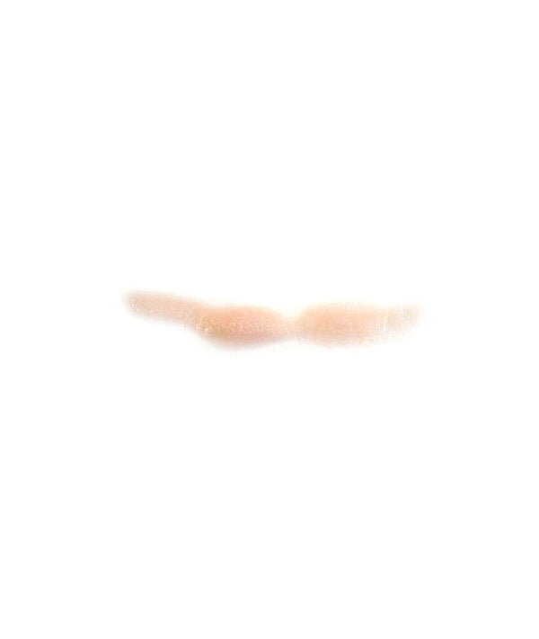 Curved Keloid Scar 6