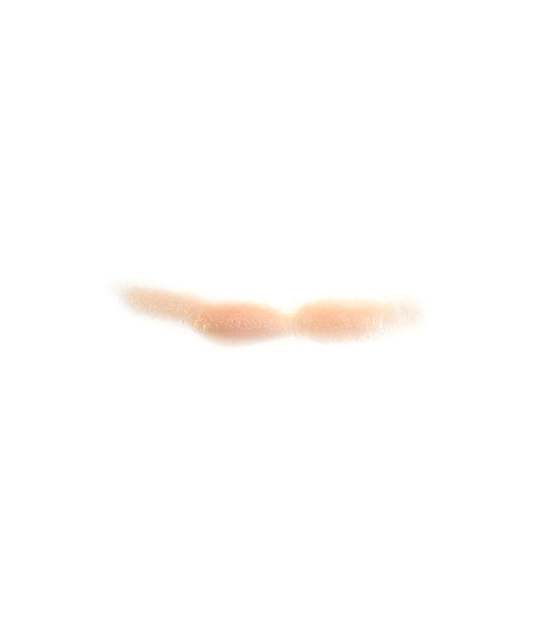 Curved Keloid Scar 6