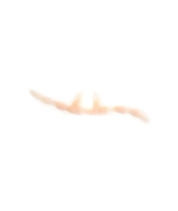 Split Keloid Scar