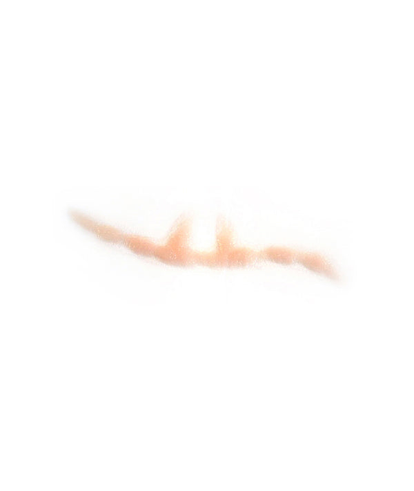 Split Keloid Scar