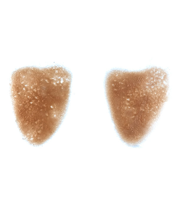 Acne Scars Large